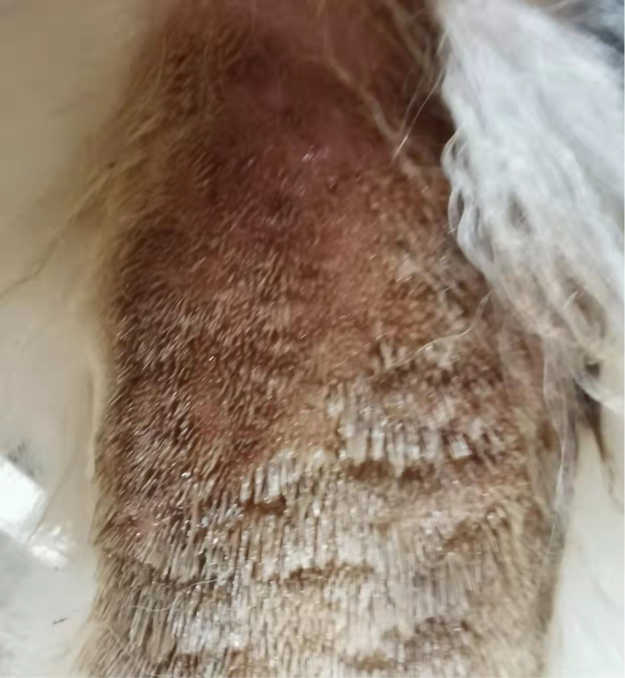 常见的寄生虫性皮肤病有哪些