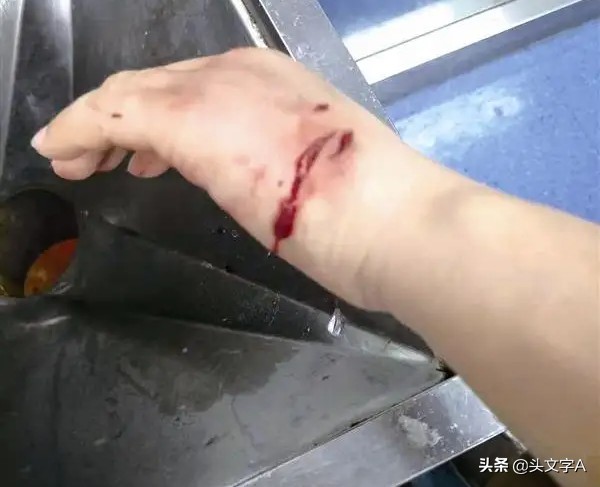 流浪狗对社会的危害