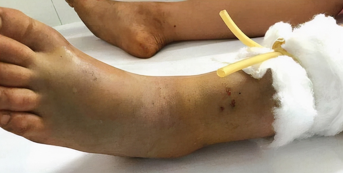 蛇会保护主人是真的吗?（附：宠物蛇会认主人吗）