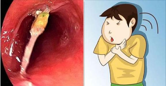 猫嗓子像卡了痰一样 猫喉咙里有痰音叫声哑