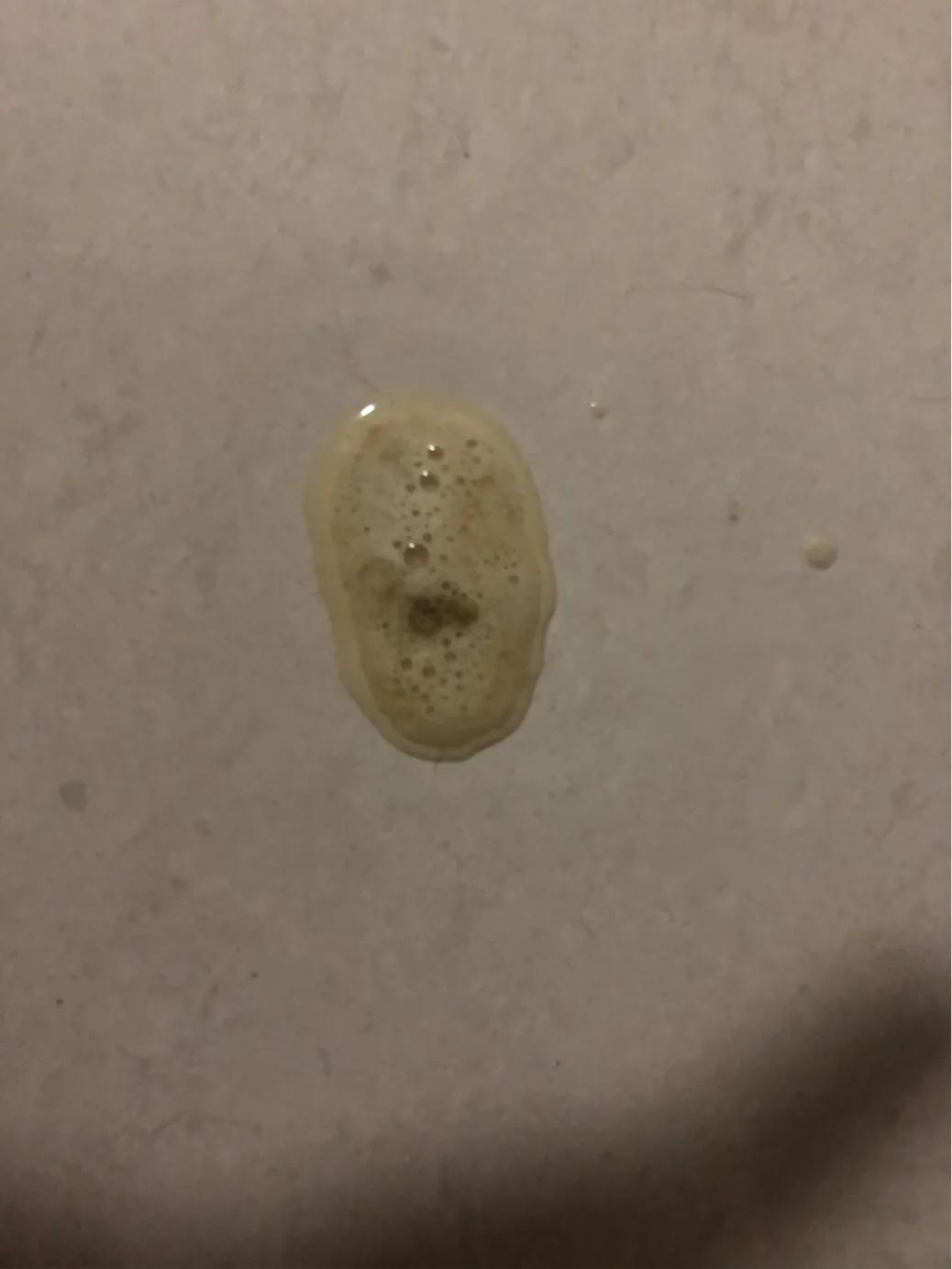 猫咪肠胃炎好转的迹象有哪些（猫咪得了肠胃炎怎么办及猫肠胃炎症状表现）