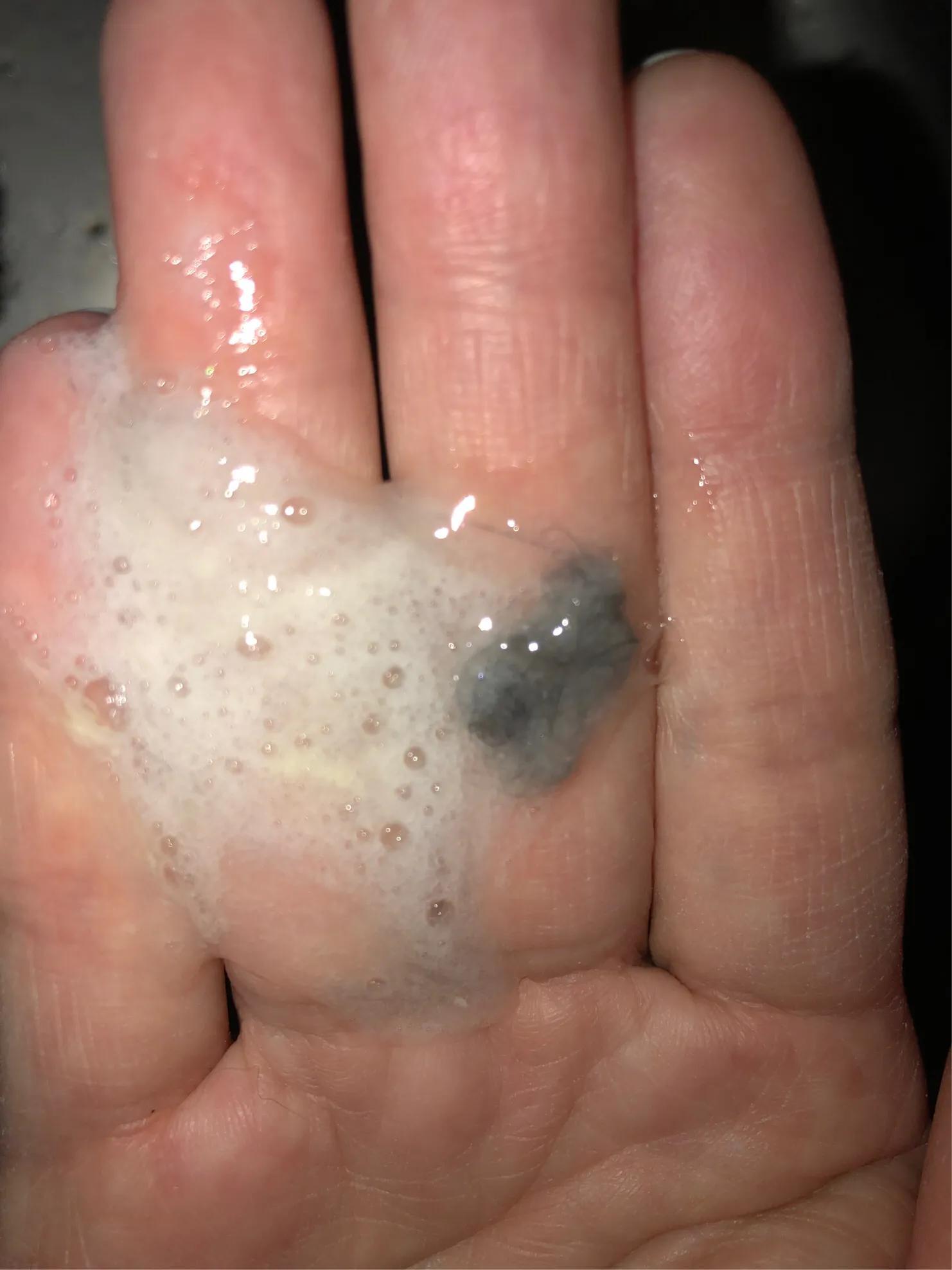 猫咪肠胃炎好转的迹象有哪些（猫咪得了肠胃炎怎么办及猫肠胃炎症状表现）