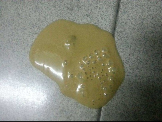 狗细小的症状是什么样（狗狗得细小之后的症状详解）