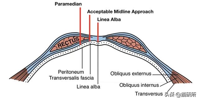 母猫绝育是切哪里(母猫绝育是摘除什么)