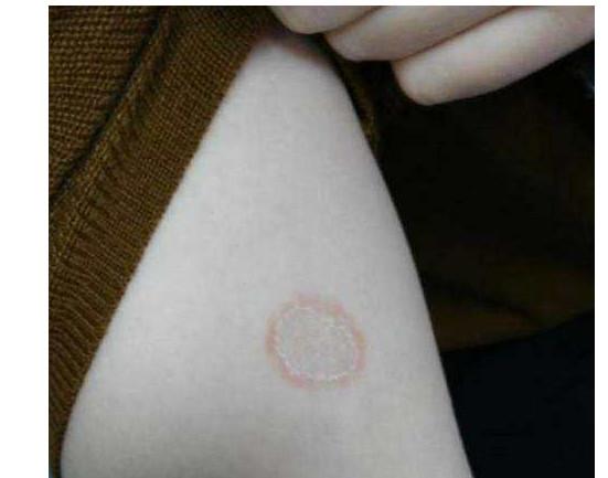 猫身上伤口长有白色皮屑怎么办（猫身上长有白色皮屑解决办法）