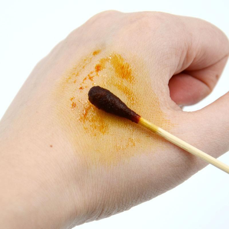 狗咬什么程度不用打针图片（注意：有两种情况不需要打疫苗）